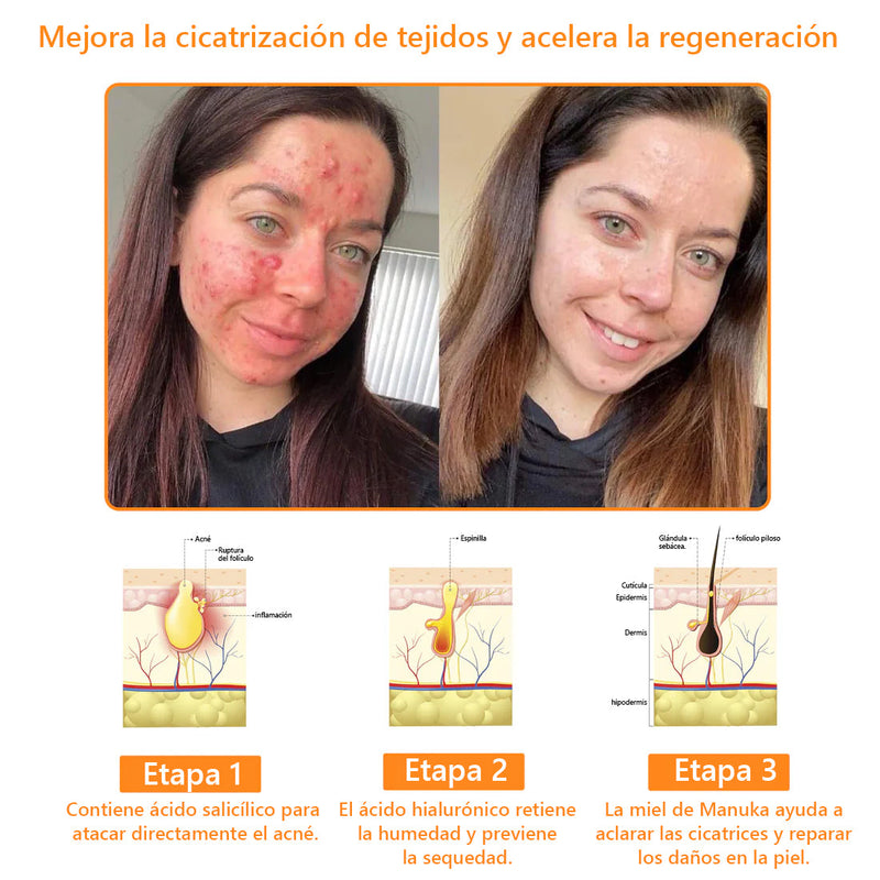 Lenaro™ Crema para el cuidado de la piel multifunción