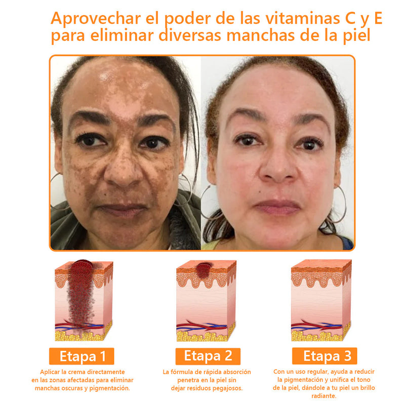 Lenaro™ Crema para el cuidado de la piel multifunción